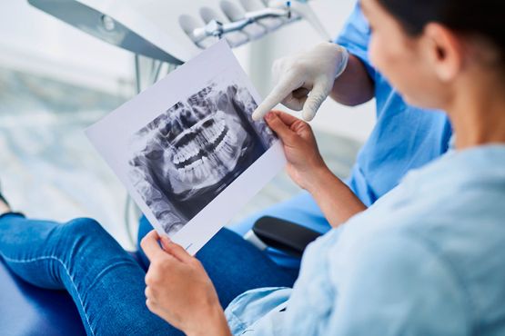 Clínica Dental Toledo 48 radiografía de dientes